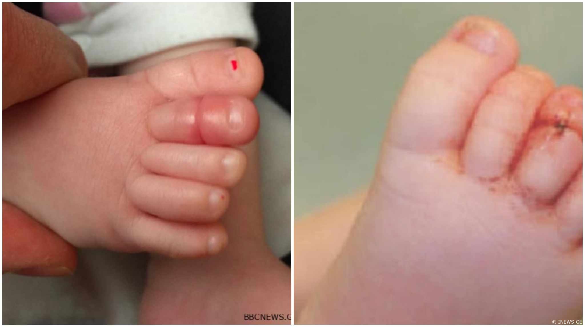 თუ ასეთ რამეს შეამჩნევთ ბავშვს, განგაში ატეხეთ