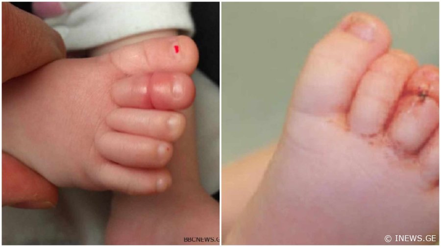 თუ ასეთ რამეს შეამჩნევთ ბავშვს, განგაში ატეხეთ