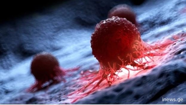 2050 წლისთვის ამ კატეგორიის კაცებში სიკვდილიანობა, შესაძლოა, 93%-ით გაიზარდოს - კვლევა