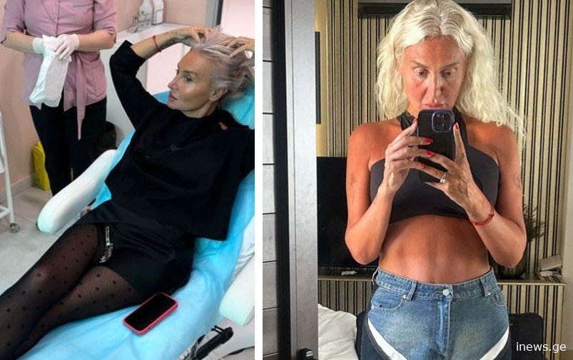 47 წლის ხარ თუ 22-ის - ნანუკა ჟორჟოლიანის ახალმა კადრებმა გამომწერები კვლავ გადარია