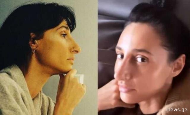 “რანაირად გეცვათ? ლოგინიდან ადექით და პირდაპირ ასე წაიყვანეთ ბავშვი?“ – რუსკა მაყაშვილი მწვავედ გააკრიტიკეს, რა უპასუხა მსახიობმა