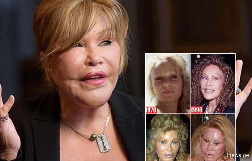 "გარდაიცვალა ქალი, რომელმაც 80 პლასტიკური ოპერაცია გაიკეთა იმ იმედით, რომ ქმრის კატას დამსგვასებოდა."