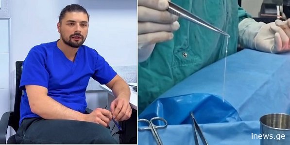 “გაიცანით ქართველი ექიმი, რომელმაც პაციენტს თავის ტვინიდან 15 სმ-იანი ცოცხალი ჭია ამოუღო..” – ნახეთ წარმოუდგენელი კადრები