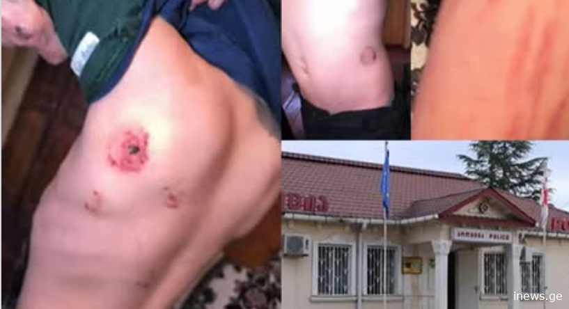 სასტიკი ძალადობა ბავშვზე სამეგრელოში - არასრულწლოვანი ბიჭი ბებიამ საღორეში ჩაკეტილი იპოვა, რომელსაც მრავლობითი დაზიანებები, მათ შორის ნაკბენები ჰქონდა
