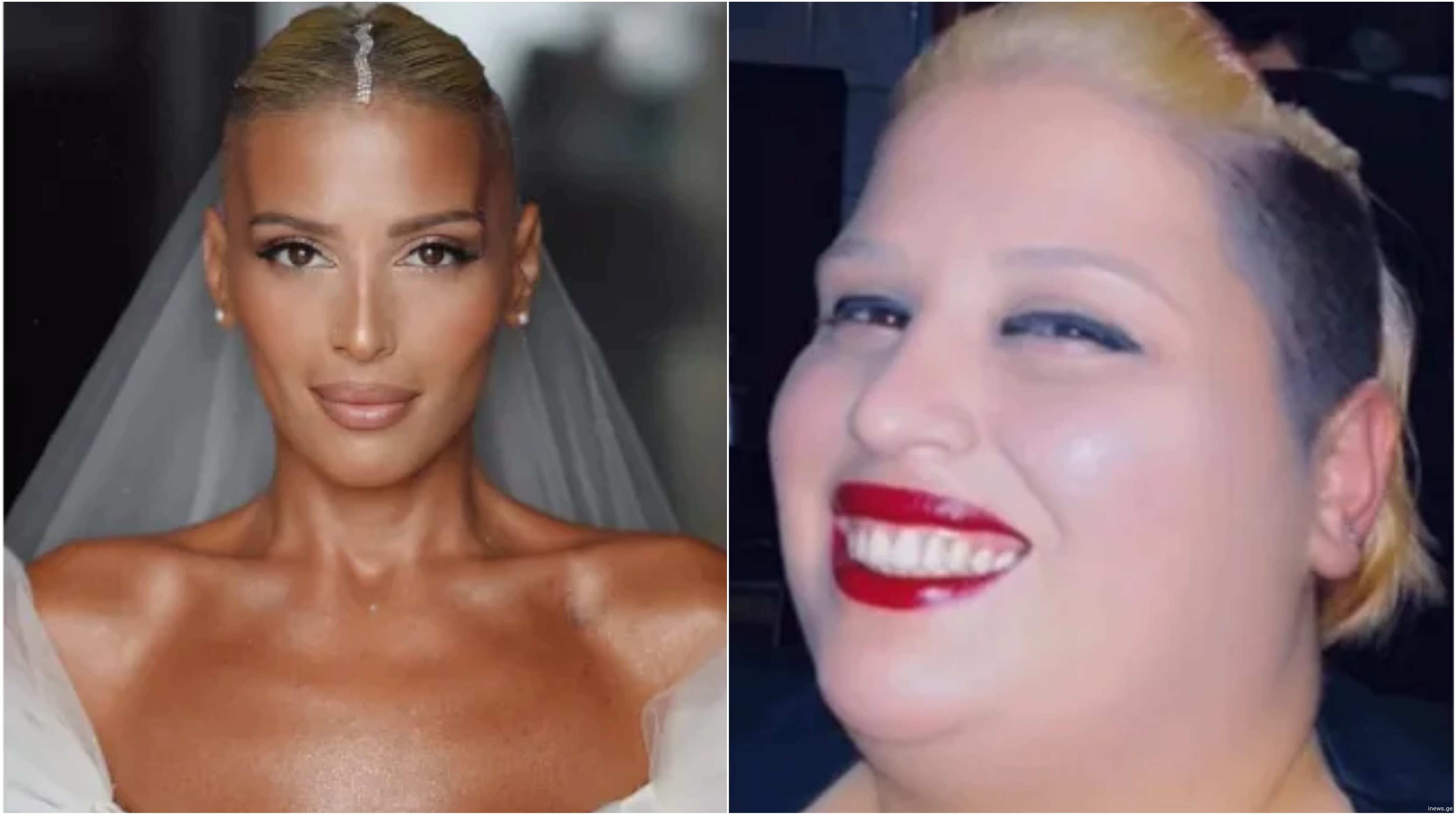 როგორ დაიკლო სოფო აბაიშვილმა 120 კილოგრამი? - დაუჯერებელი ისტორია