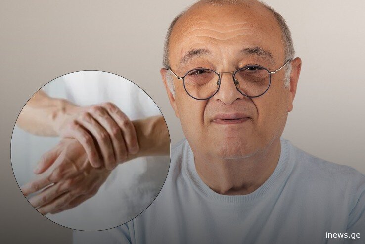 რა იწვევს ხელებისა და ფეხების დაბუჟებას - ნეიროქირურგი ყველაზე გავრცელებულ მიზეზებზე საუბრობს