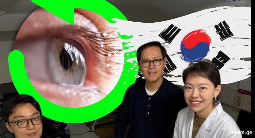 ეს გადატრიალებაა მეცნიერებაში - კორეელმა შეიმუშავეს თვალის ბადურის აღდგენის ახალი მეთოდიკა