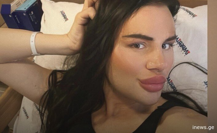 ლორენ მასხულიამ მკერდის ოპერაცია ტრაბზონში გაიკეთა