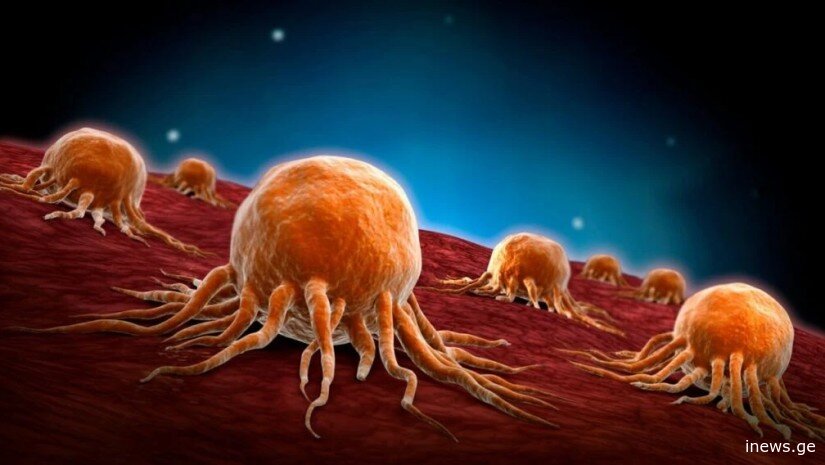 კიბოს ნიშნები, რომლებიც, შესაძლოა, ჭამის დროს გამოვლინდეს