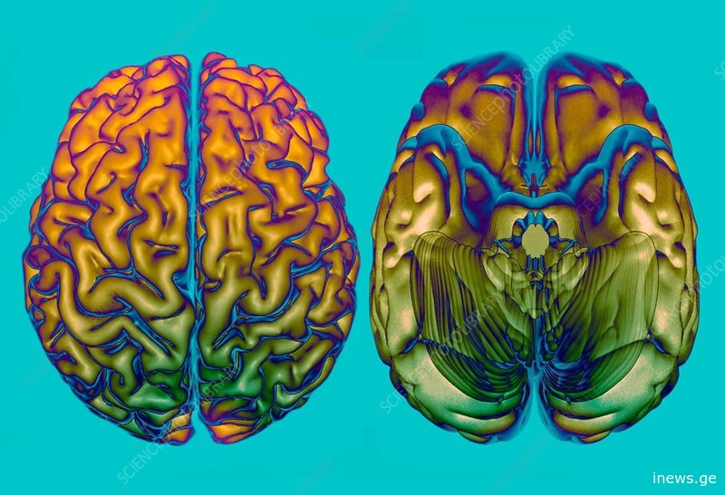 მეცნიერებმა ტვინის გადატვირთვის ღილაკი აღმოაჩინეს